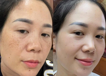 Chị Ngọc Mai