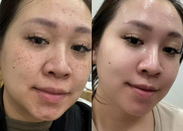 Chị Lan Anh